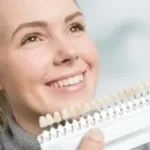 What You Need To Know About Veneers for a Flawless Smile