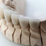 Why Crowns Are Essential for Restoring Teeth After Trauma
