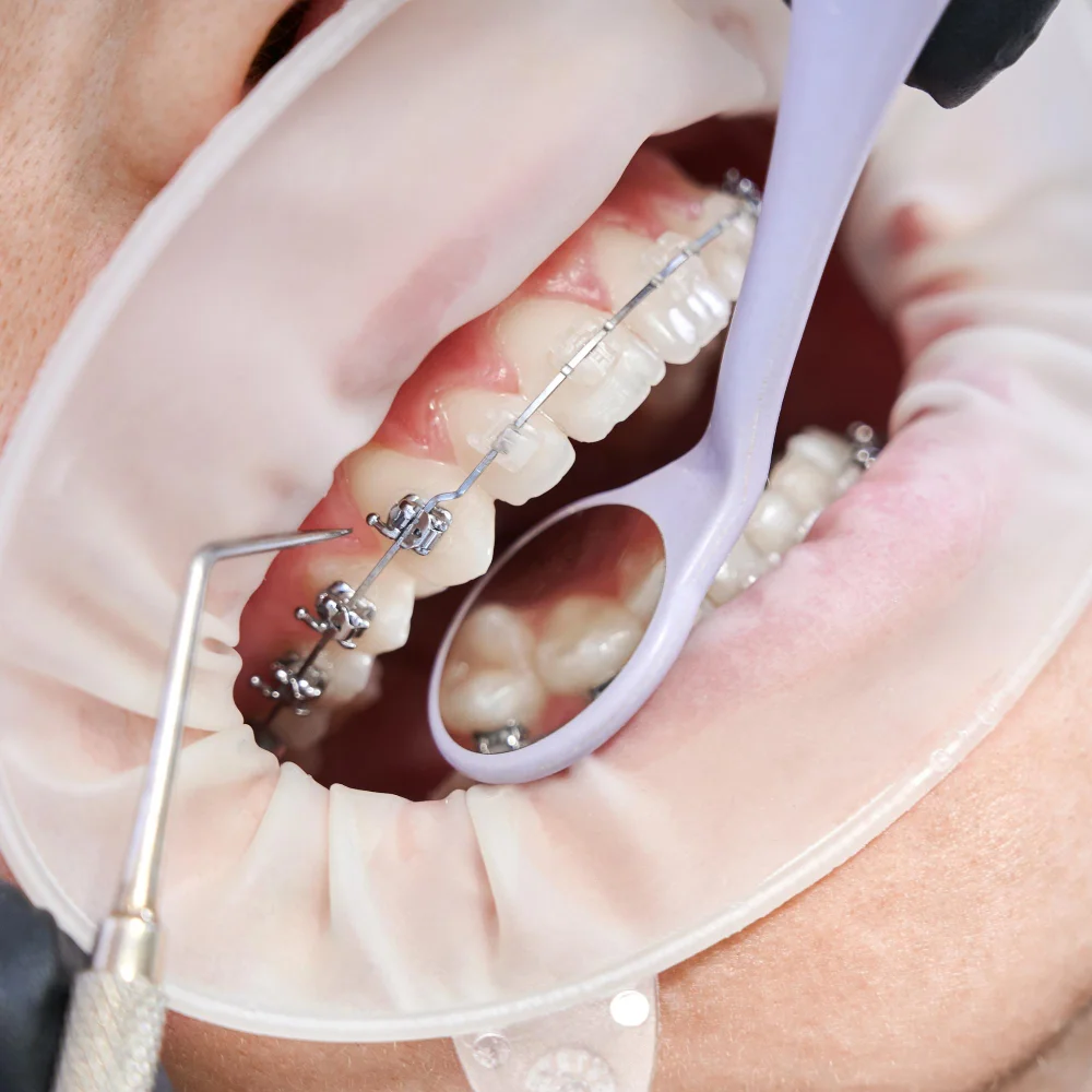 Why Regular Visits to the Dentist Are Crucial for Preventing Tooth Loss