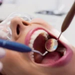 Why Veneers Are a Game-Changer for Those With Imperfect Teeth