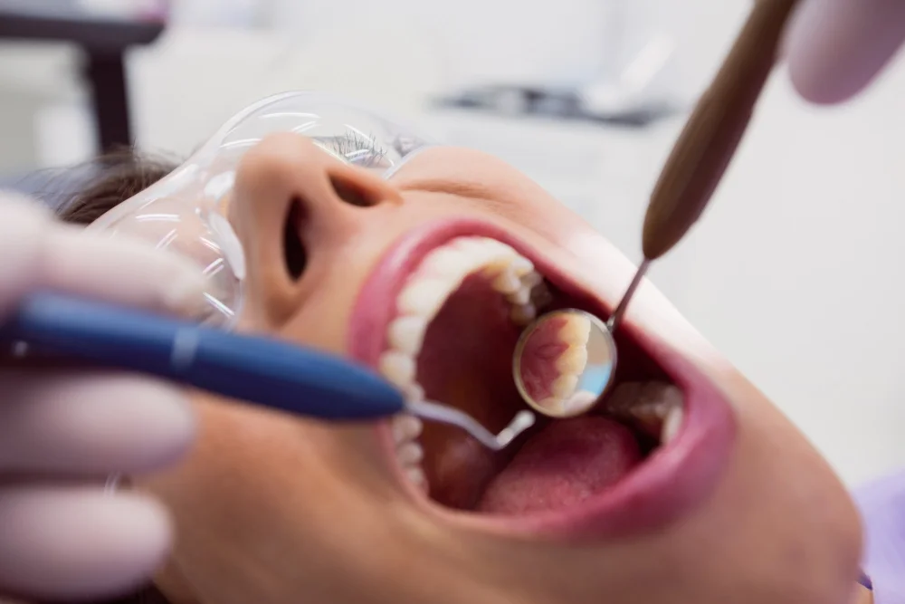 Why Veneers Are a Game-Changer for Those With Imperfect Teeth