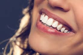 How To Choose a Teeth Whitening Treatment for Your Smile