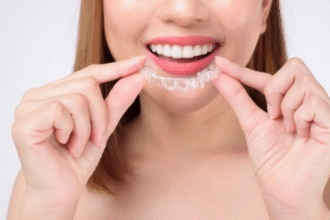 When To Ask a Cosmetic Dentist About Clear Aligners