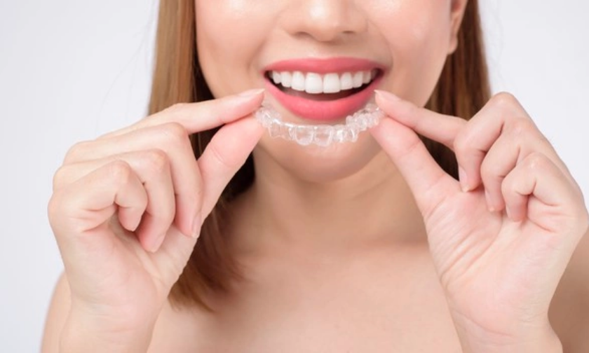 When To Ask a Cosmetic Dentist About Clear Aligners