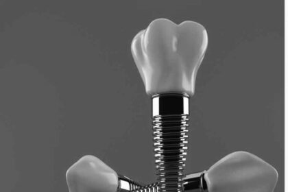 Dental Implants for Older Adults: Why Age Doesn’t Matter
