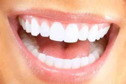 How Veneers Can Transform Your Smile and Boost Your Confidence