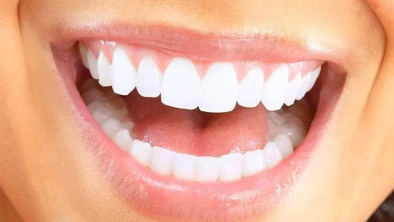 How Veneers Can Transform Your Smile and Boost Your Confidence