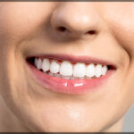 The Science Behind Effective Teeth Whitening Techniques