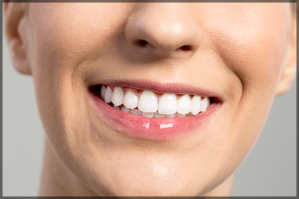 The Science Behind Effective Teeth Whitening Techniques