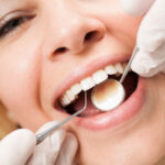 Understanding the Benefits of Regular Teeth Cleaning