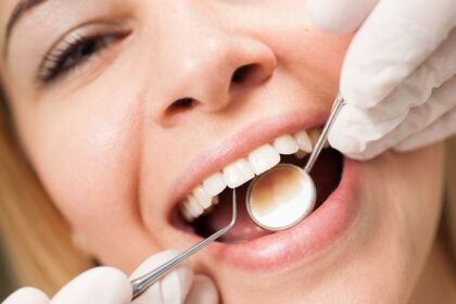 Understanding the Benefits of Regular Teeth Cleaning