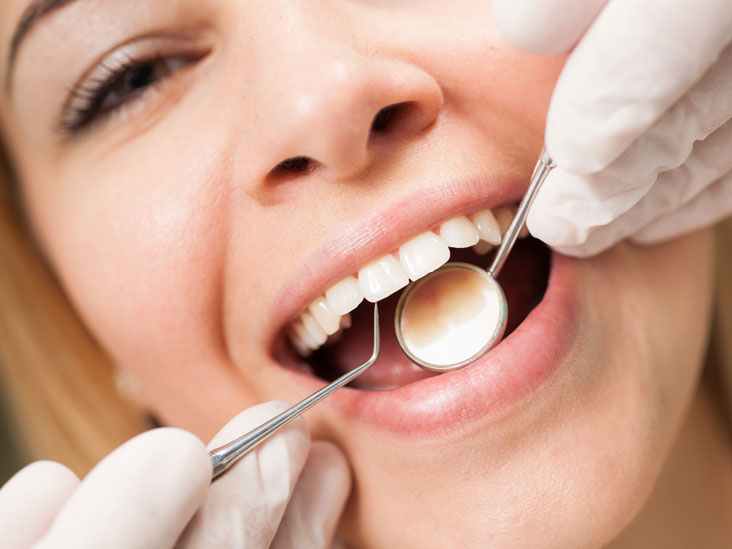Understanding the Benefits of Regular Teeth Cleaning