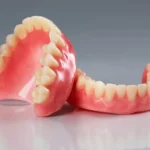 Understanding the Different Types of Dentures Available