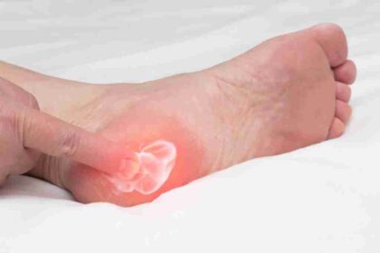 4 Ways Doctors Treat Plantar Fasciitis
