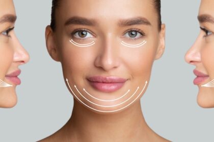 Benefits of a Face Lift for Aging Skin