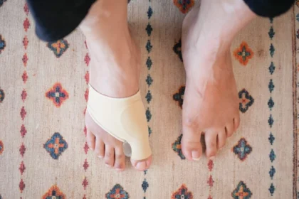 Choosing the Right Shoes for Bunions