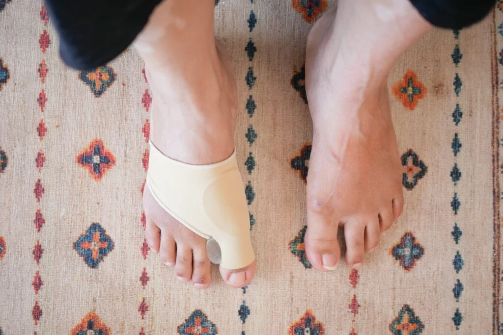 Choosing the Right Shoes for Bunions