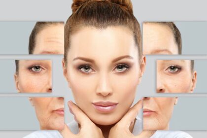 Common Areas for Dermal Fillers and What to Expect