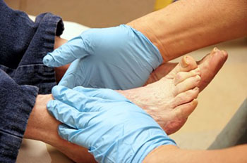 Foot Care Tips for Diabetics From Podiatry Experts