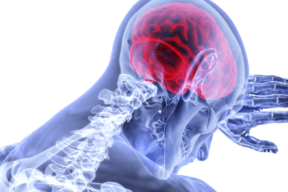 How Neurology Helps Diagnose Rare Conditions