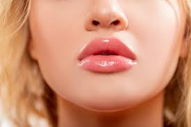 How to Care for Your Lips After Getting Fillers