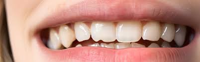 Recognizing Cracked Teeth and What You Should DoRecognizing Cracked Teeth and What You Should Do