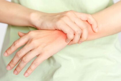 Recognizing Early Symptoms of Arthritis Pain