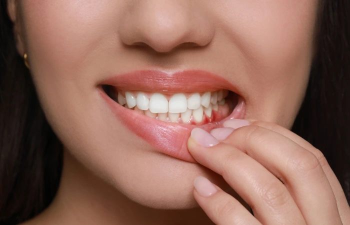 Recognizing the Early Signs of Gum Disease