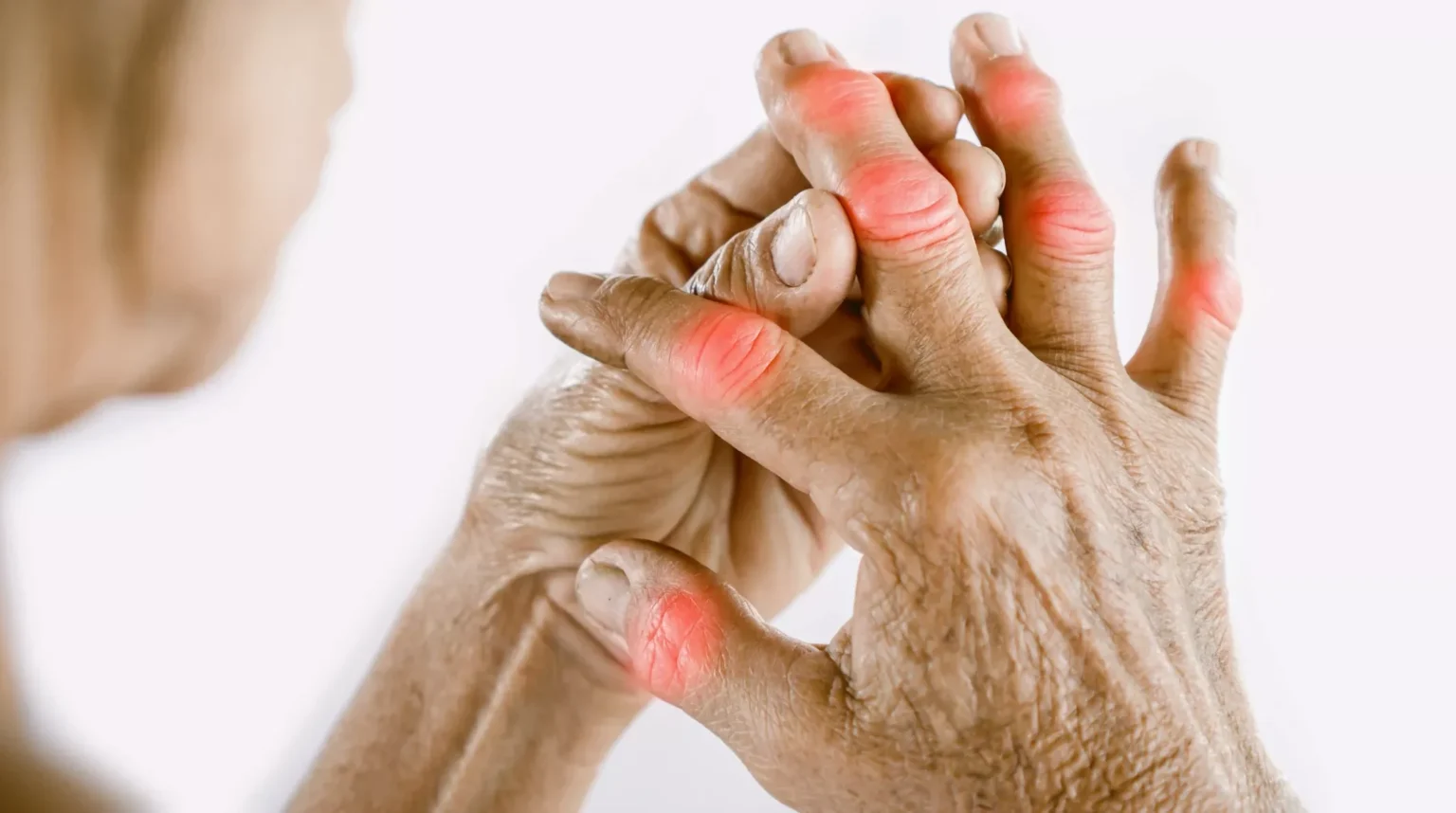 Recognizing the Signs of Arthritis Early