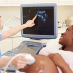The Importance of Regular Obstetric Check-ups
