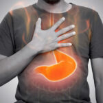 The Role of Acid Reflux in Gastroesophageal Disorders