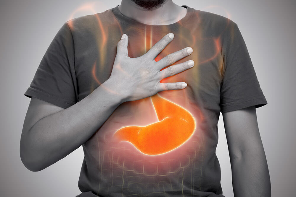 The Role of Acid Reflux in Gastroesophageal Disorders