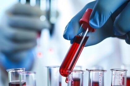 The Role of Early Detection for Colon Cancer