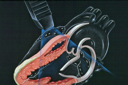 Understanding Echocardiograms in Cardiac Diagnostics