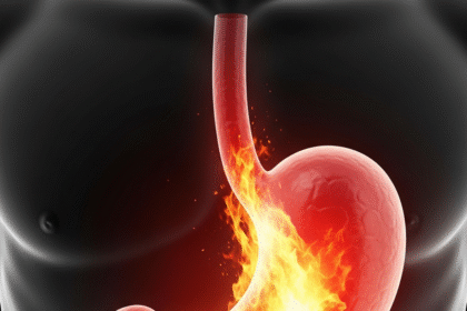 Understanding Gastroesophageal Reflux Disease (GERD)