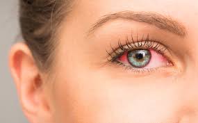 Understanding the Causes and Symptoms of Dry Eyes