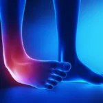 Understanding the Different Grades of Ankle Sprains and Their Implications