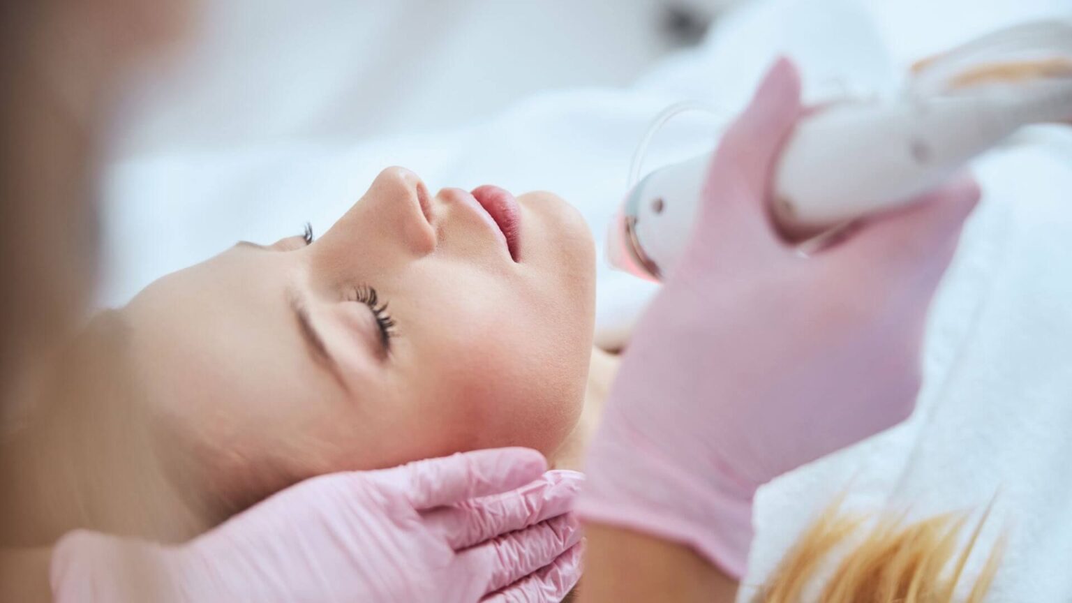 Understanding the Different Types of Chemical Peels