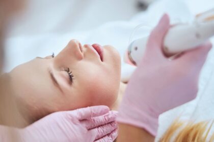 Understanding the Different Types of Chemical Peels