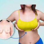 What Happens if I Don’t Like My Breast Implants?