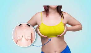 What Happens if I Don’t Like My Breast Implants?