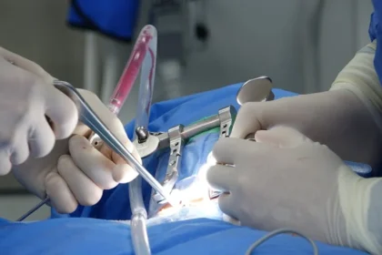 What To Expect Before, During, and After Robotic Surgery