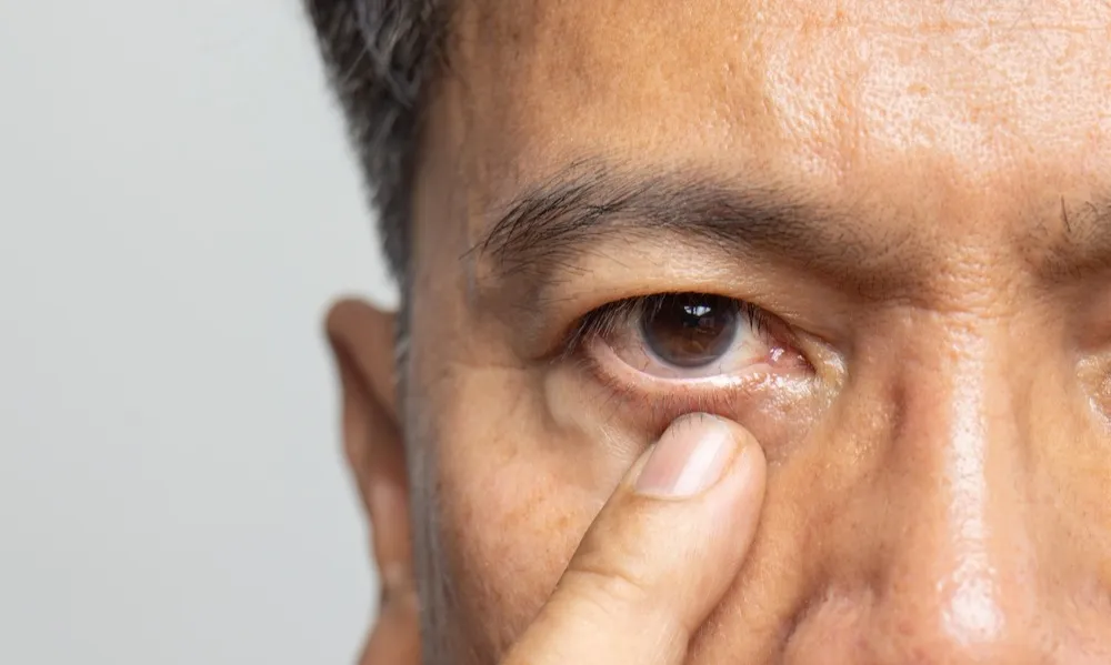 What To Expect During Your Visit to a Cataracts Specialist