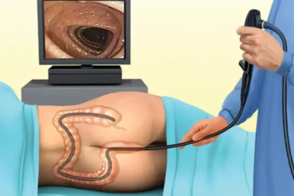 What to Expect During a Colonoscopy