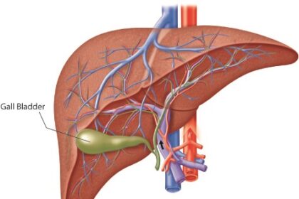The Role of General Surgery in Treating Digestive Disorders