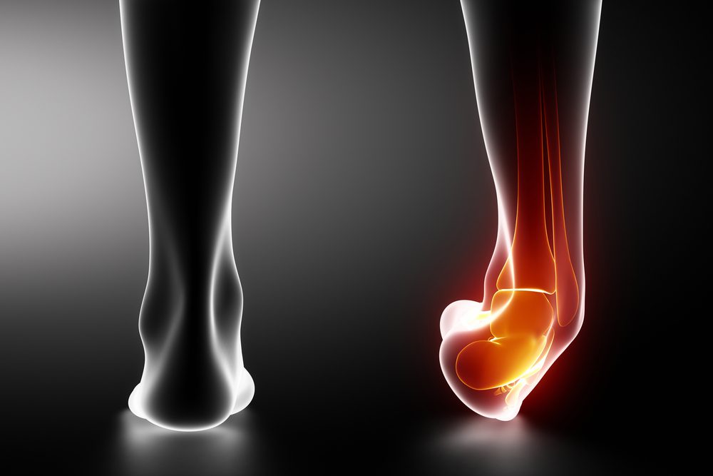 Understanding the Causes and Treatment Options for Ankle Sprains