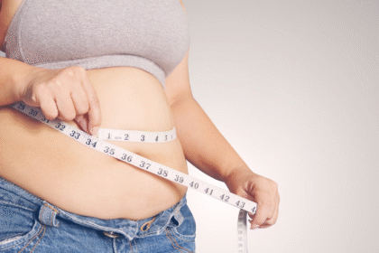 Who Is a Candidate for Bariatric Surgery?