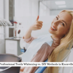 Why Choose Professional Teeth Whitening Over DIY Options