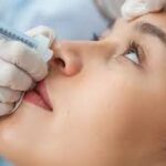 Understanding What Happens During a Botox Procedure