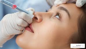 Understanding What Happens During a Botox Procedure